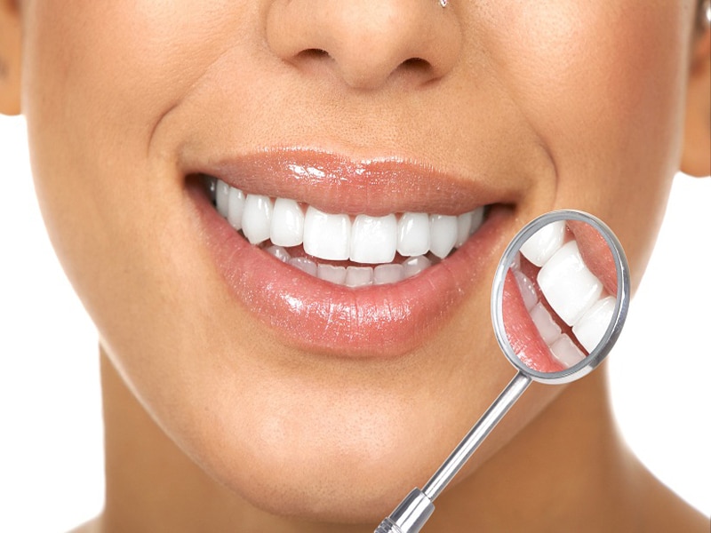 همه چیز در مورد روکش دندان در تهران + مزایا و معایب | فرزانه فرخ نژاد دندانپزشک زیبایی