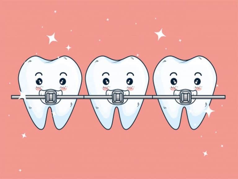 همه چیز در مورد ارتودنسی نامرئی - دکتر فرزانه فرخ نژاد دکترای دندانپزشکی