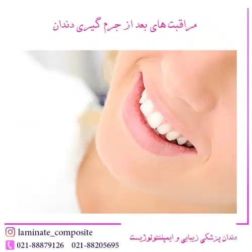 جرم گیری دندان در تهران 2 بهترین متخصص جرم گیری دندان در تهران