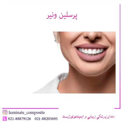 اصلاح نامرتبی دندان ها بدون ارتودنسی 2 اصلاح نامرتبی دندان ها بدون ارتودنسی | فرزانه فرخ نژاد دندانپزشک زیبایی