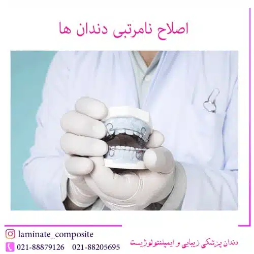 اصلاح نامرتبی دندان ها بدون ارتودنسی 1 اصلاح نامرتبی دندان ها بدون ارتودنسی | فرزانه فرخ نژاد دندانپزشک زیبایی