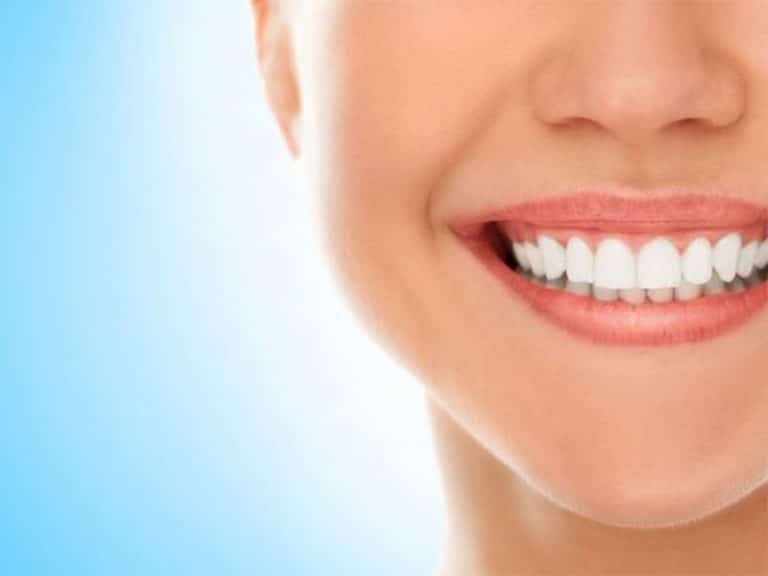 اصلاح نامرتبی دندان ها بدون ارتودنسی - دکتر فرزانه فرخ نژاد دکترای دندانپزشکی