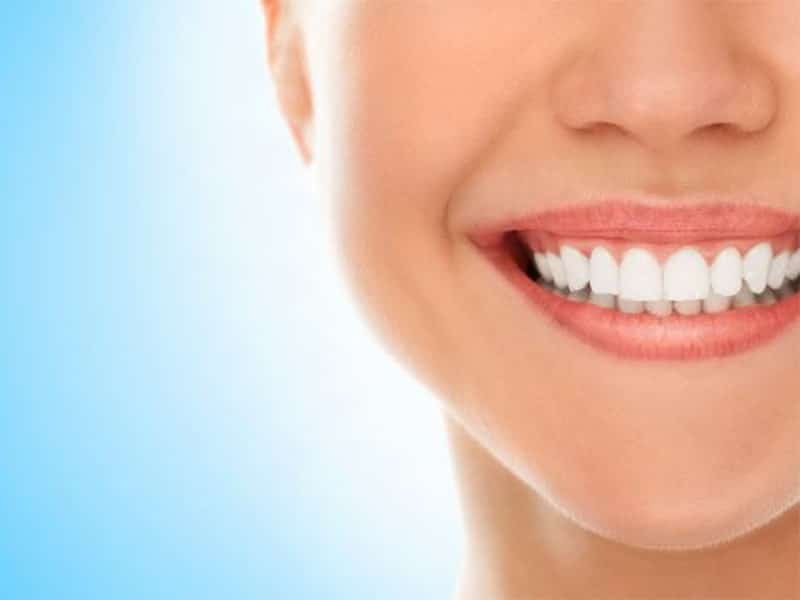 اصلاح نامرتبی دندان ها بدون ارتودنسی