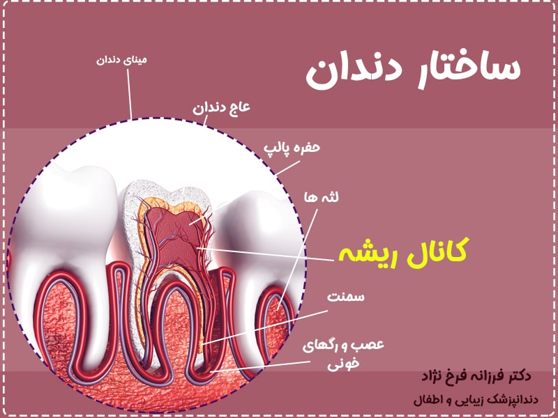درمان ریشه دندان در تهران