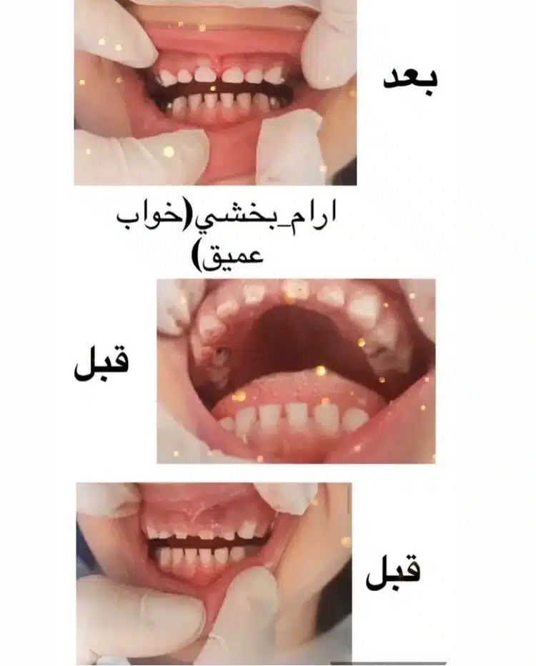 بهترین- دندانپزشک- اطفال -در تهران