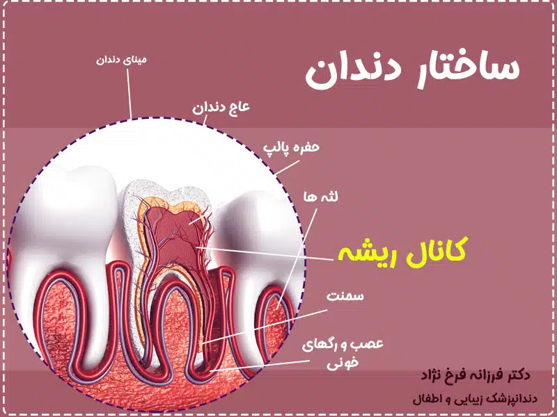 درمان ریشه دندان در تهران 1 درمان ریشه دندان در تهران