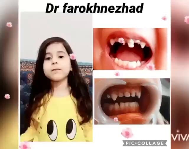 نمونه کار دندانپزشکی اطفال