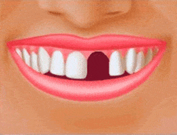 بهترین دکتر ایمپلنت دندان در تهران - دکتر فرزانه فرخ نژاد دکترای دندانپزشکی