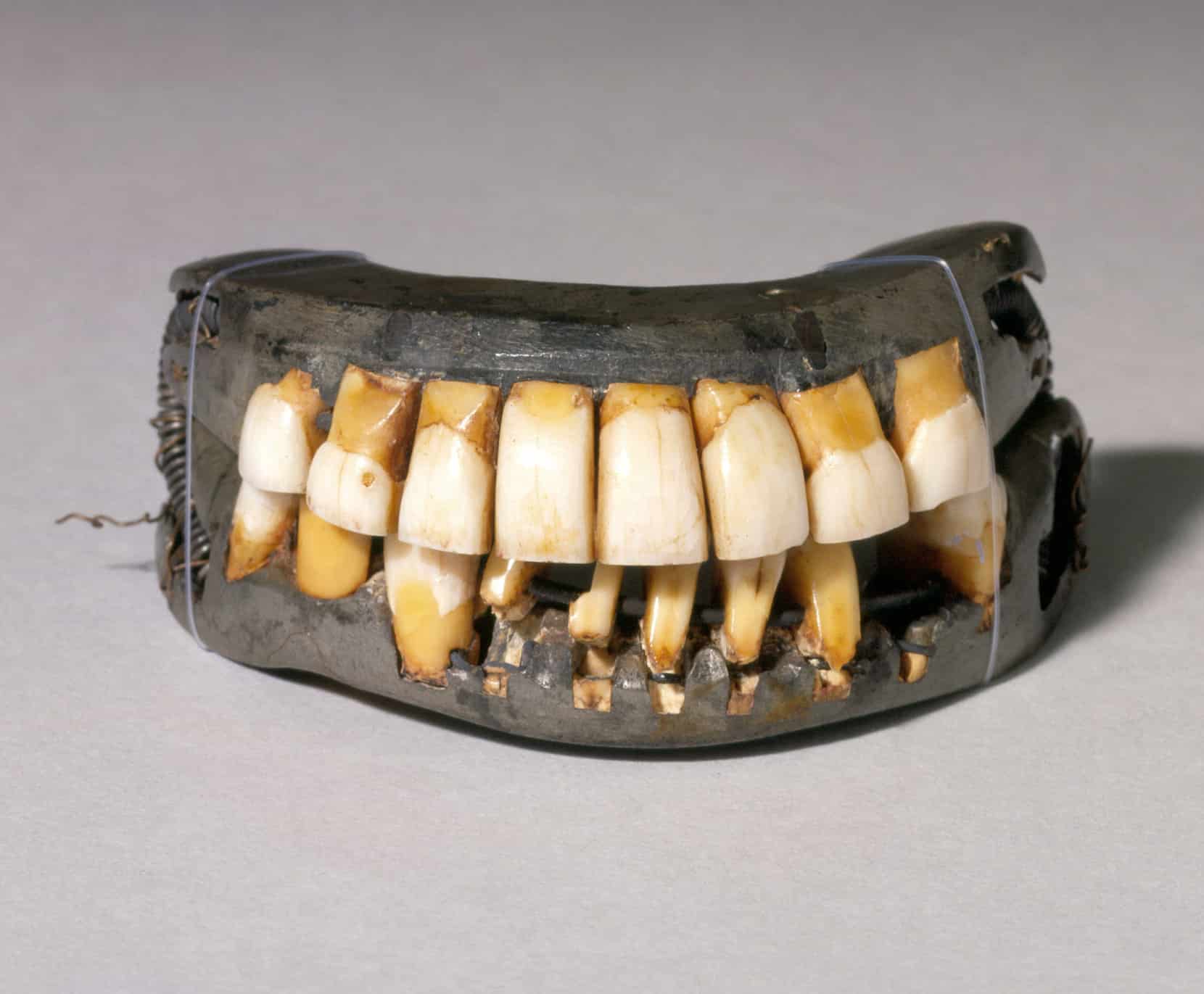 لمینیت دندان - دکتر فرزانه فرخ نژاد دکترای دندانپزشکی