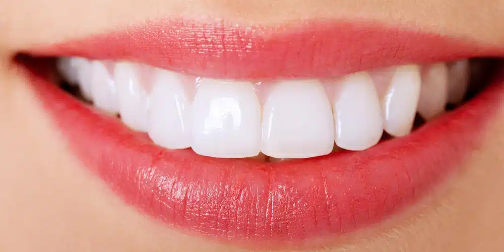 هزینه دندان‌پزشکی زیبایی 
