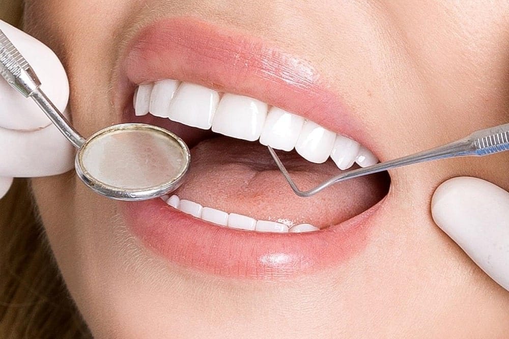 دوام و عمر مفید لمینت دندان