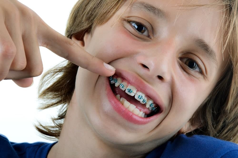 روش‌های درمانی ارتودنسی دندان کودکان