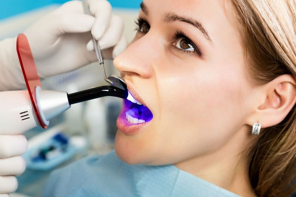عوامل موثر بر عمر کامپوزیت دندان