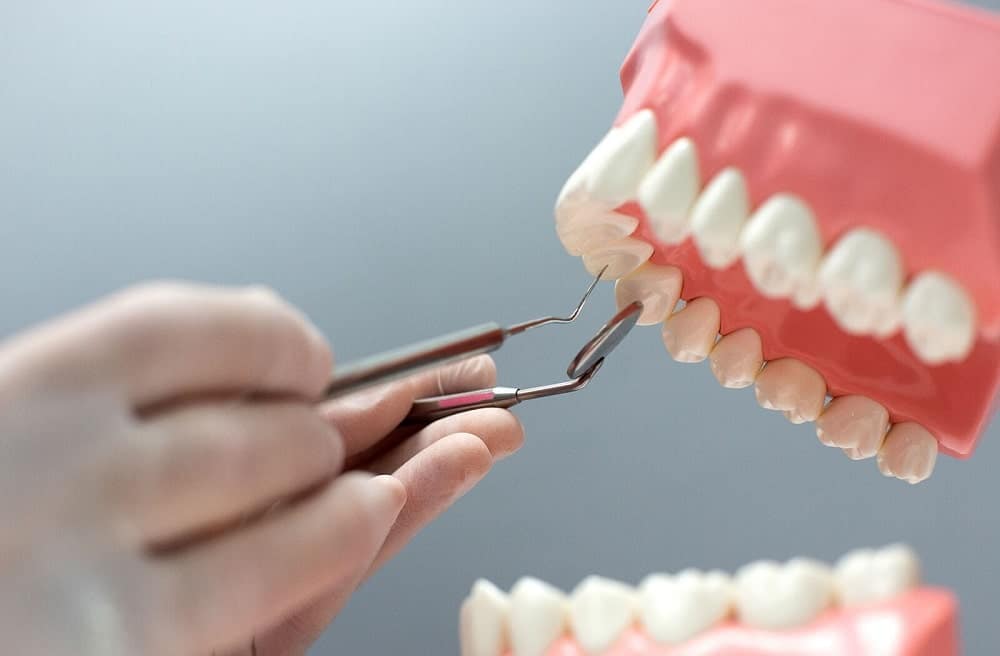 منظور از کامپوزیت دندان چیست؟