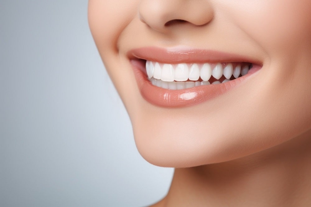 لمینیت دندان 16 ایمکس دندان