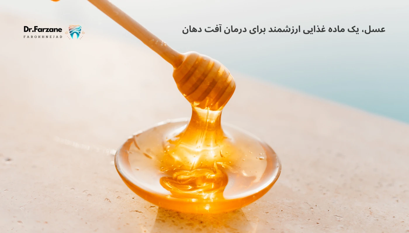 آفت دهان: علت ها، علائم و روش های درمان فوری Mouth Ulcers 3 عسل، یک ماده غذایی ارزشمند و درمانگر